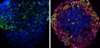 comparison between uncorrected cells from patient with neonatal diabetes and cells after CRISPR